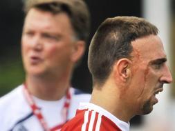 Van Gaal califica como irritante el caso Ribery y se declara molesto por su teatro