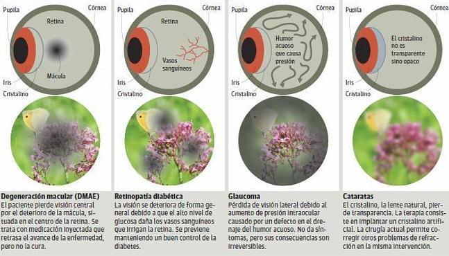 Cerco a los grandes enemigos de la visin